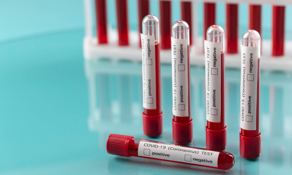 saaudee.com - imagem.pixabay