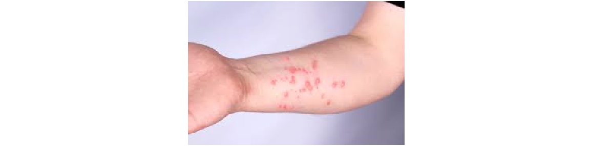 saaudee.com - imagem.Google