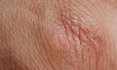 saaudee.com - imagem.pexels