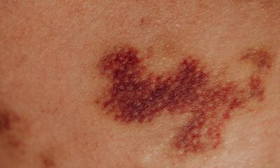 saaudee.com - imagem.pexels