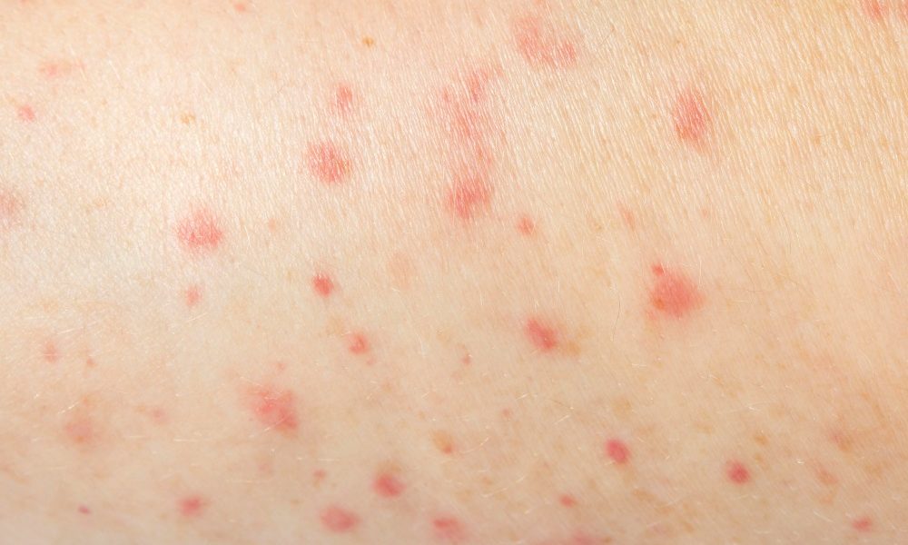 saaudee.com - imagem.freepik