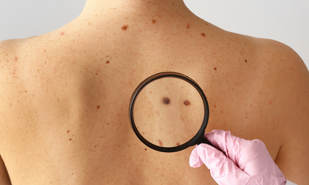 saaudee.com - imagem.pixabay