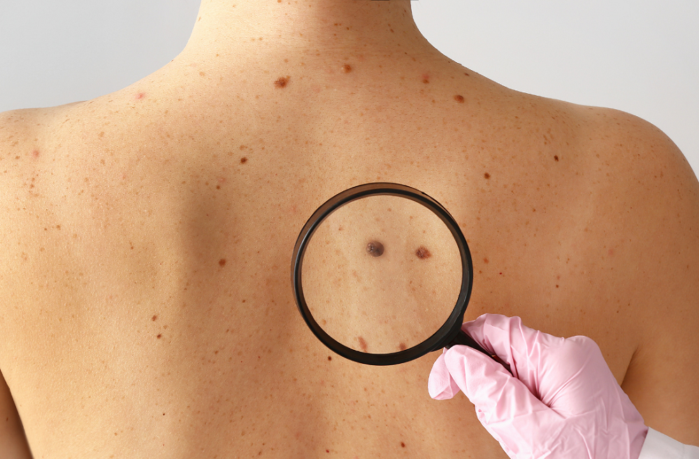 saaudee.com - imagem.pixabay