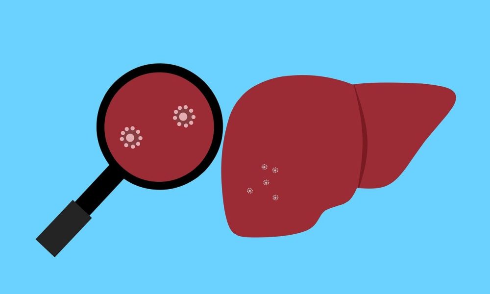 saaudee.com - imagem.pixabay