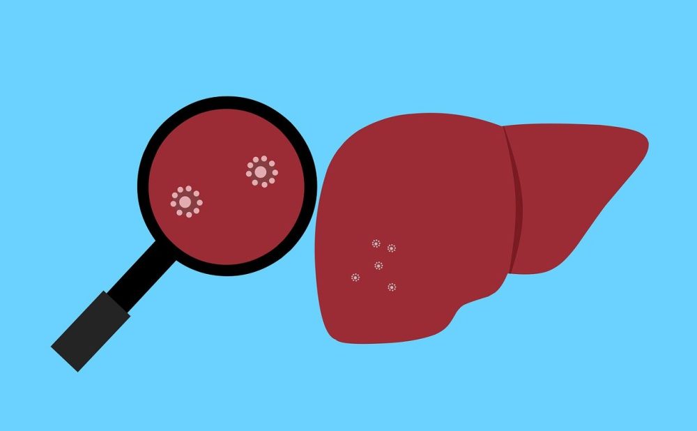 saaudee.com - imagem.pixabay